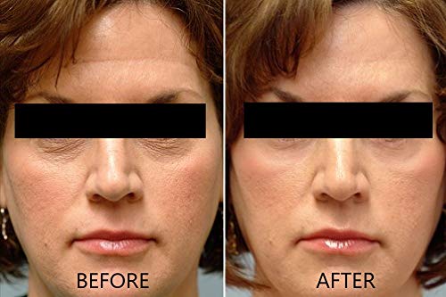 Vitamin C Serum 20% Pure L-Ascorbic Acid, Ferulic Acid, Vitamin E and Hyaluronic Acid for Face and Eyes