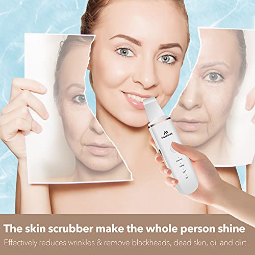 Skin Scrubber Face Skin Spatula Blackhead Remover Pore Cleaner Face Beauty Lifting Tool Comedones Extractor with 4 Modes