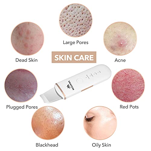 Skin Scrubber Face Skin Spatula Blackhead Remover Pore Cleaner Face Beauty Lifting Tool Comedones Extractor with 4 Modes