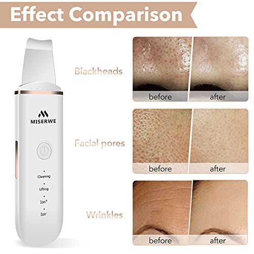 Skin Scrubber Face Skin Spatula Blackhead Remover Pore Cleaner Face Beauty Lifting Tool Comedones Extractor with 4 Modes