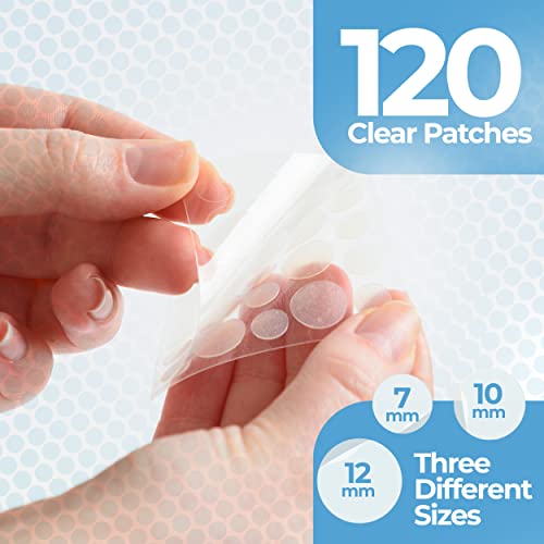 BASIC CONCEPTS Acne Patches (120 Pack)