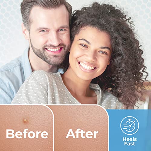 BASIC CONCEPTS Acne Patches (120 Pack)