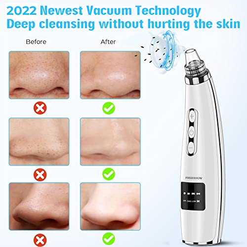 2022 Newest Blackhead Remover Pore Vacuum,Upgraded Facial Pore Cleaner